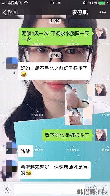 粉刺、痘痘、痘印、統(tǒng)統(tǒng)解決啦！祛痘去粉刺就是這么簡(jiǎn)單！