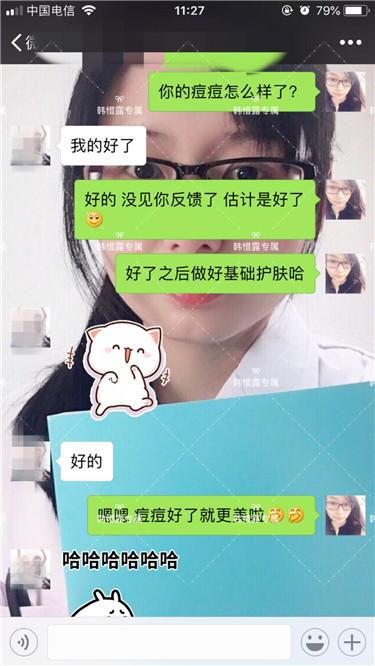 【視頻】臉上長粉刺怎樣去掉？醫(yī)院都沒搞定韓惜露幫我搞定了，超級開心！