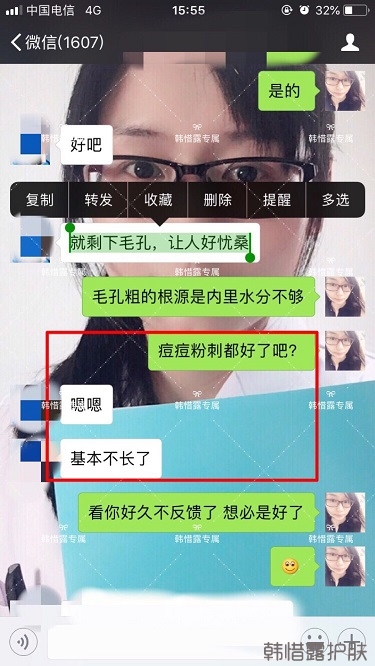 粉刺痘痘，痘印都沒了，寶媽重回顏值巔峰！