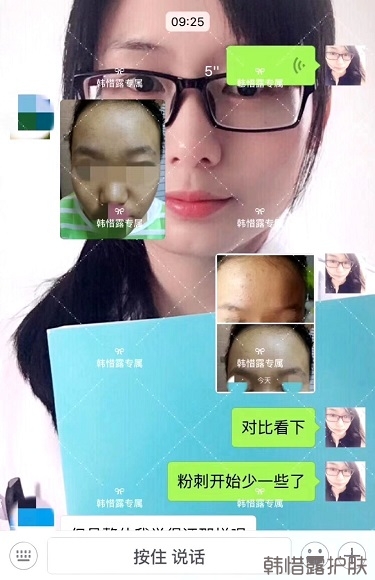 臉上長粉刺怎么辦?額頭長粉刺怎么辦?