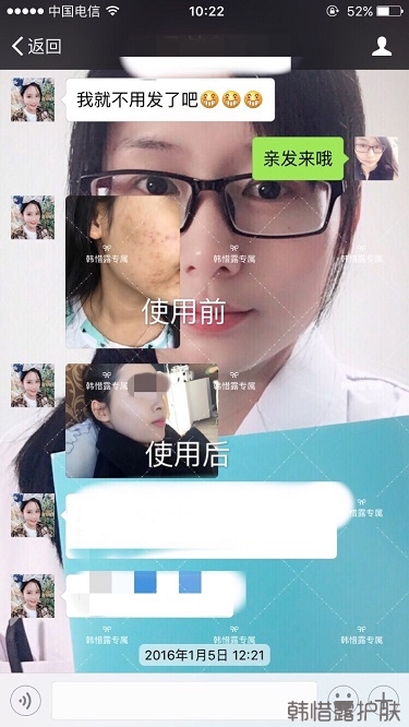 痘花妹變無暇美女