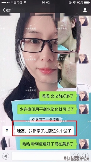 痘痘好了皮膚美麗，不想再記起曾經滿臉痘痘的自己！