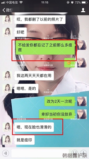 膿包痘祛痘效果,擁有干凈的臉不等待!