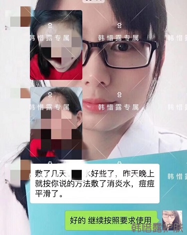 什么產品祛痘效果好?有什么祛痘效果好的產品?