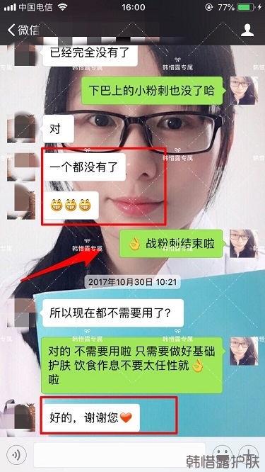 粉刺密密麻麻，試過很多方法無果后找韓惜露老師輕松去掉粉刺！