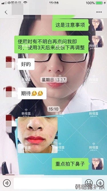 鼻子發(fā)紅長痘痘消了，皮膚吸收好就是任性！