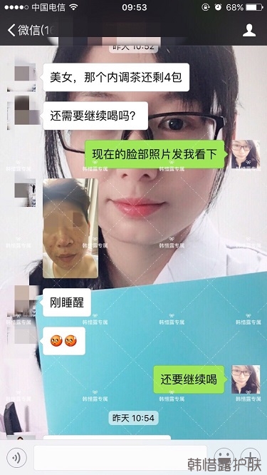 膿包結節發硬痘痘全消了，帥哥開心的來反饋了！