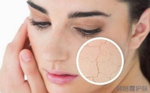 祛痘護(hù)膚小知識(shí)之:如何判斷自己的膚質(zhì)?