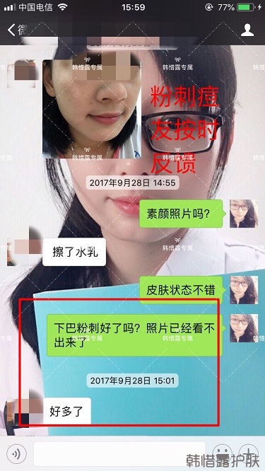 粉刺密密麻麻，試過很多方法無果后找韓惜露老師輕松去掉粉刺！