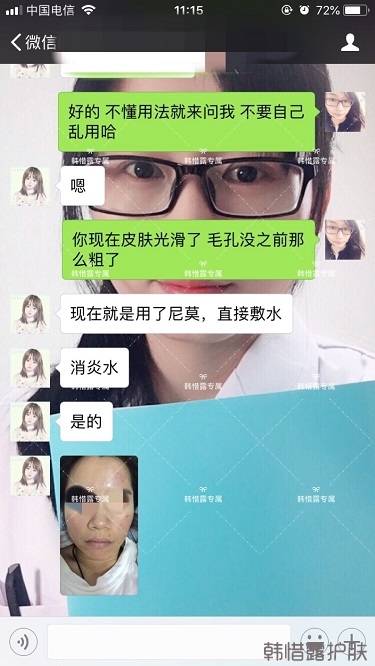 膿包痘祛痘效果,擁有干凈的臉不等待!