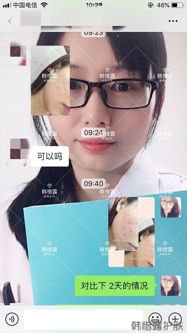 祛痘，痘痘發炎痘印就選它！