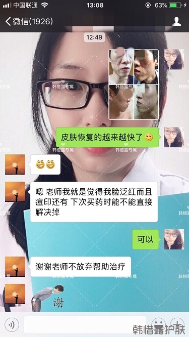 長痘痘找韓惜露，祛痘效果反饋